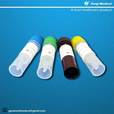 Πραγματικός - χρονικό RT PCR εξεταστική εξάρτηση νουκλεϊνικού οξέος με τα δείγματα πτύελου