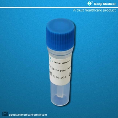95% ευαισθησία SAR-Cov-2 Oropharyngeal Nasopharyngeal εξαρτήσεων εγχώριας δοκιμής