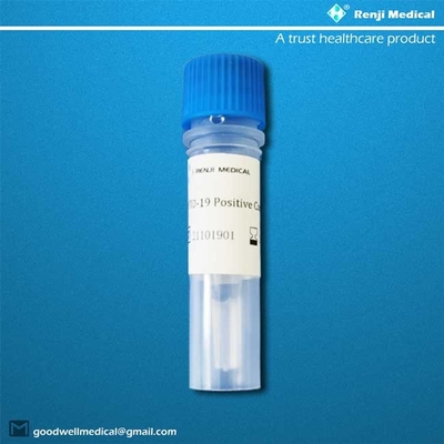Covid-19 νέα υψηλή ικανότητα εξαρτήσεων δοκιμής Coronavirus που εξετάζει την έγκριση μΑ YBTC