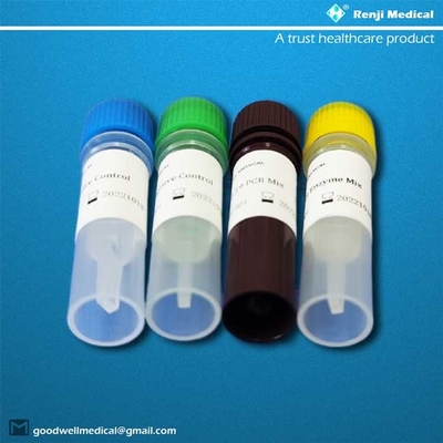 ORF1ab/N SGS εξαρτήσεων Coronavirus γονιδίων νέα εξεταστική πιστοποίηση